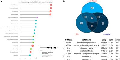 Transcriptome Analysis of Monocytes and Fibroblasts Provides Insights Into the Molecular Features of Periodontal Ehlers-Danlos Syndrome